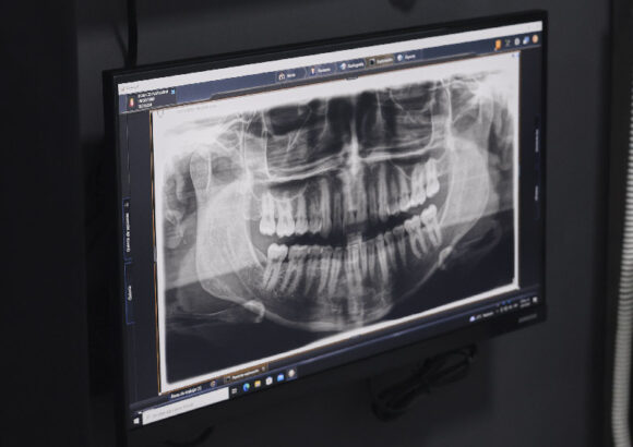 Radiología